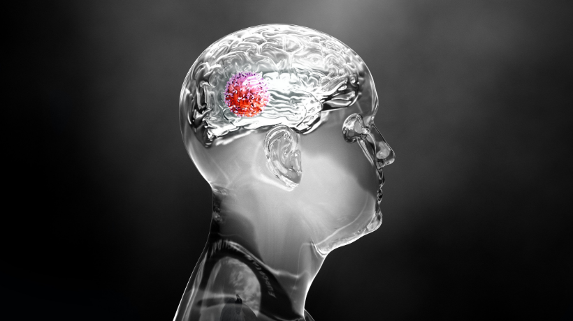 CONNECT-1903: New trial for kids' brain cancer